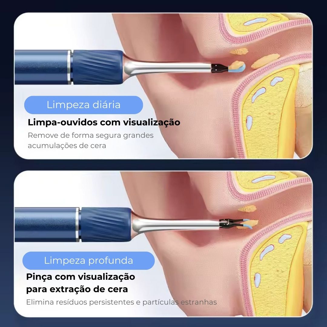 Limpa-ouvidos inteligente sem fios com câmara 4K (Android/iOS)